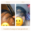 Adult Hair Growth Oil (8 oz)